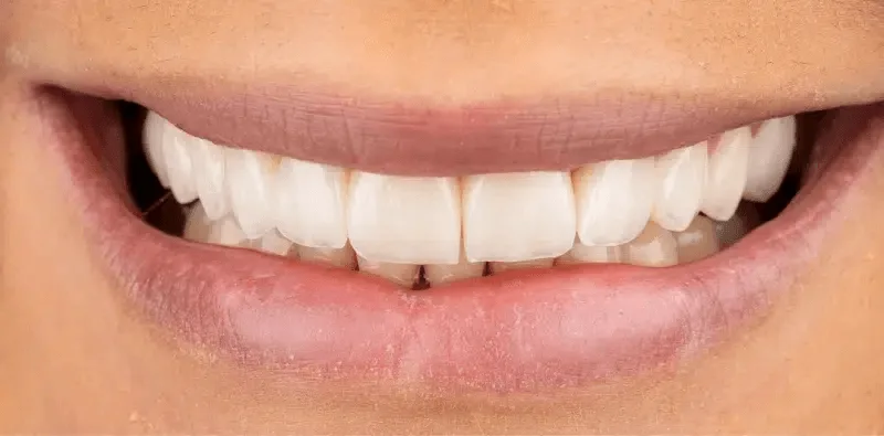 A second patient's smile after treatment at Central Washington Dental Care
